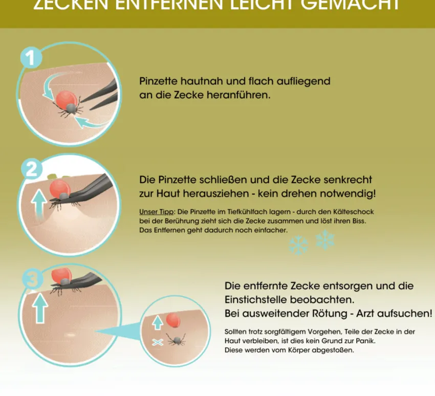Sale Canal Instrumente Canal Zeckenpinzette für Menschen 11cm
