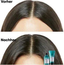 Hot L'Oréal Professionnel Paris L'Oréal Scalp Advanced Anti-Discomfort Dermo-Regulator Shampoo