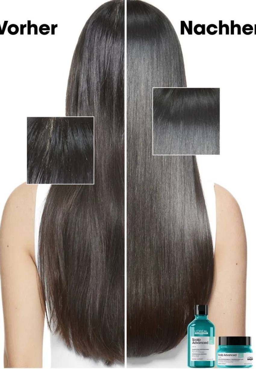 Hot L'Oréal Professionnel Paris L'Oréal Scalp Advanced Anti-Oiliness 2-in-1 Deep Purifier Clay