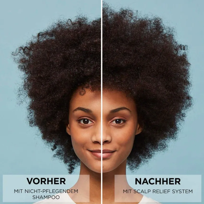 Hot Nioxin Scalp Relief 3-Stufen-System
